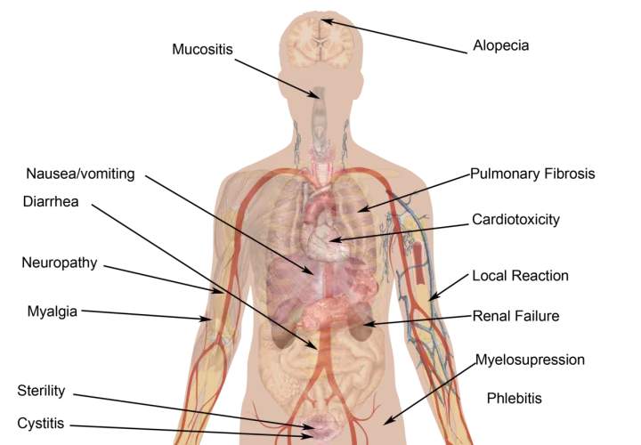 Side Effects of Chemotherapy