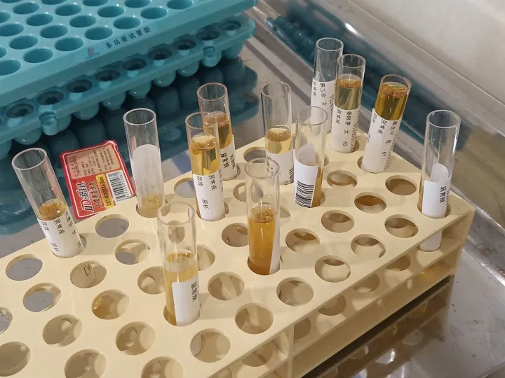 Urine test samples