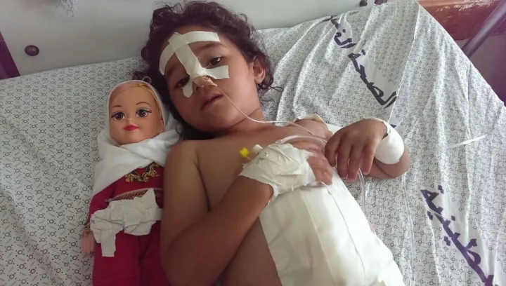 Shaymaa al-Masri, five years old, at a-Shifaa Hospital, Gaza. Shaymaa was injured when her uncle’s house was bombed in the early afternoon of 9 July 2014