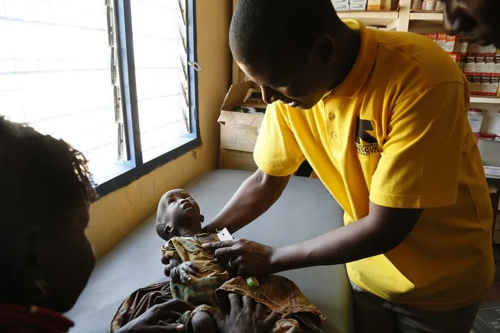 A Young Child Suffering Health issues from Malnutrition