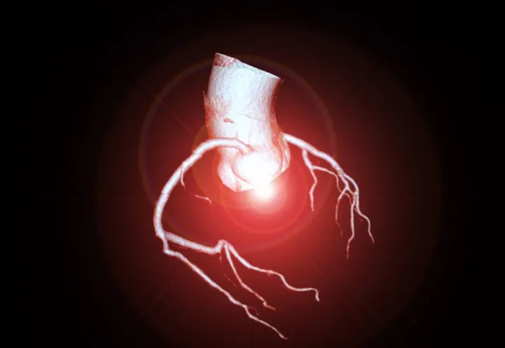 CT Coronary Artery Imaging